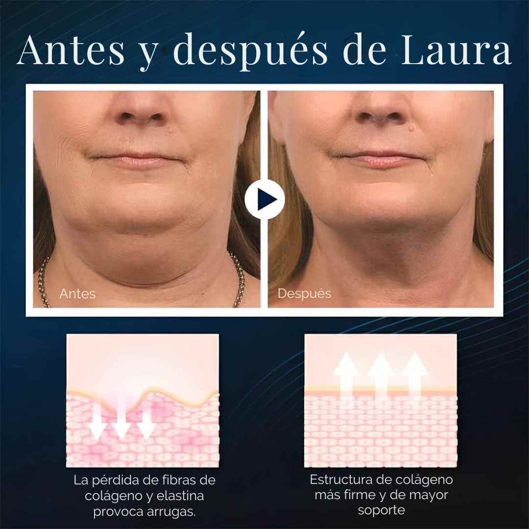 Reductor de Papada – Reafirma, Tonifica y Perfila tu Rostro sin Cirugía