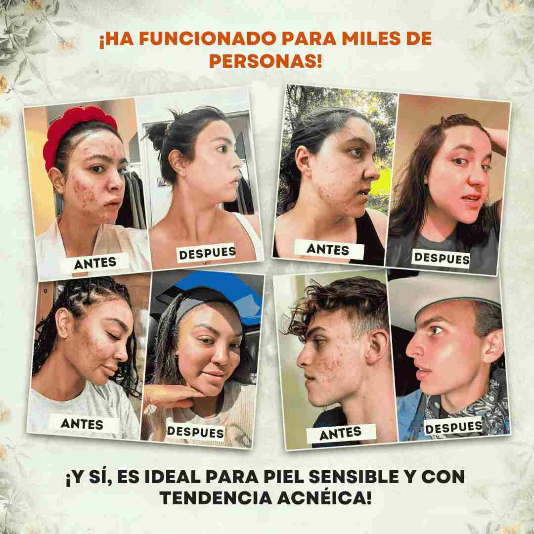 EVIL GOODS! Bálsamo de sebo de res batido y miel de Manuka, 113 g, crema facial orgánica, humectante, loción corporal, cuidado de la piel y bálsamo labial.